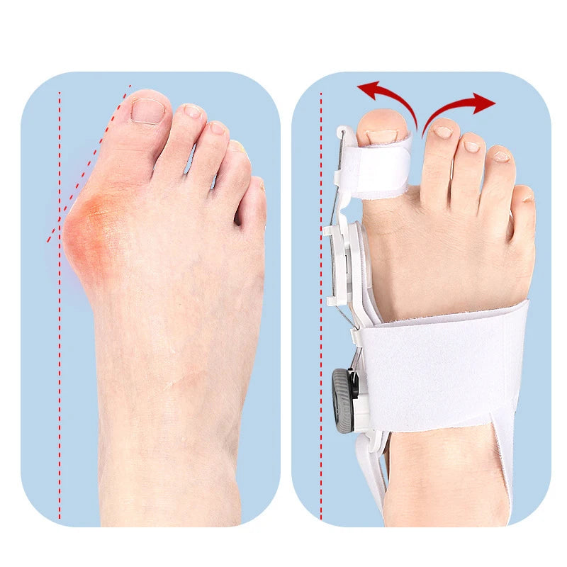 1PC Bunion Corrector Unisex Foot Hallux Valgus Braces Rotatable Toe Separator Straightener Adjustable Finger Toe Corrector